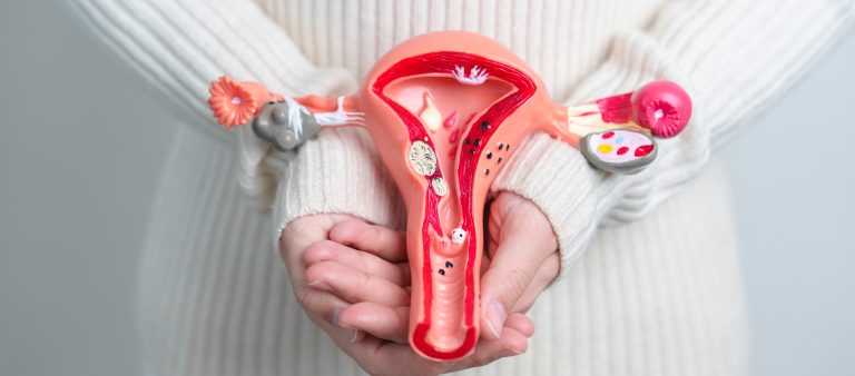 Woman holding Uterus and Ovaries model. Ovarian and Cervical can